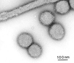 図.インフルエンザウイルスの電子顕微鏡像