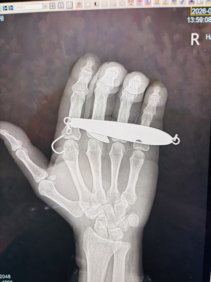 A2F6F37A-1C51-483B-B420-C19EDA0141D7